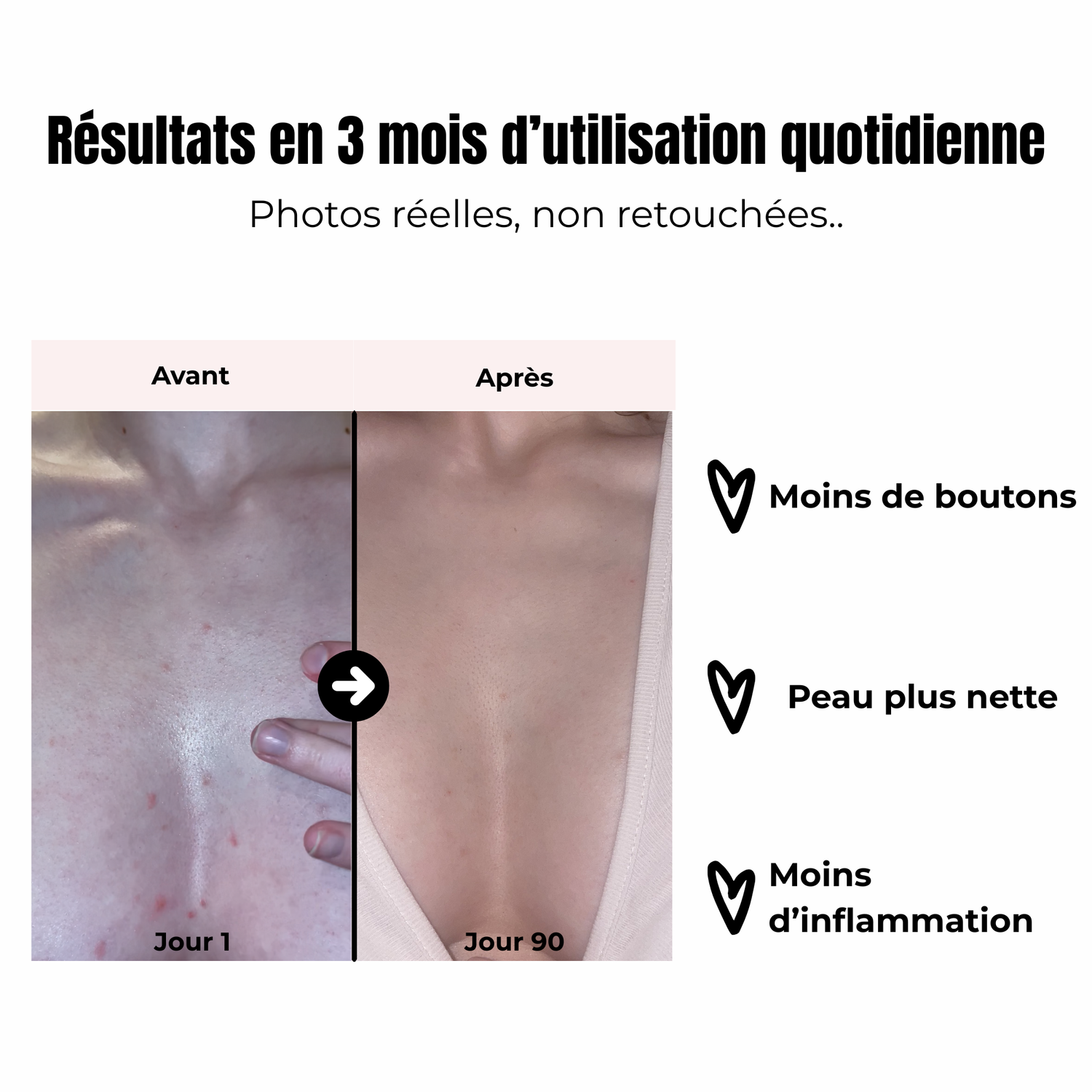 Sérum Lèvres Roses